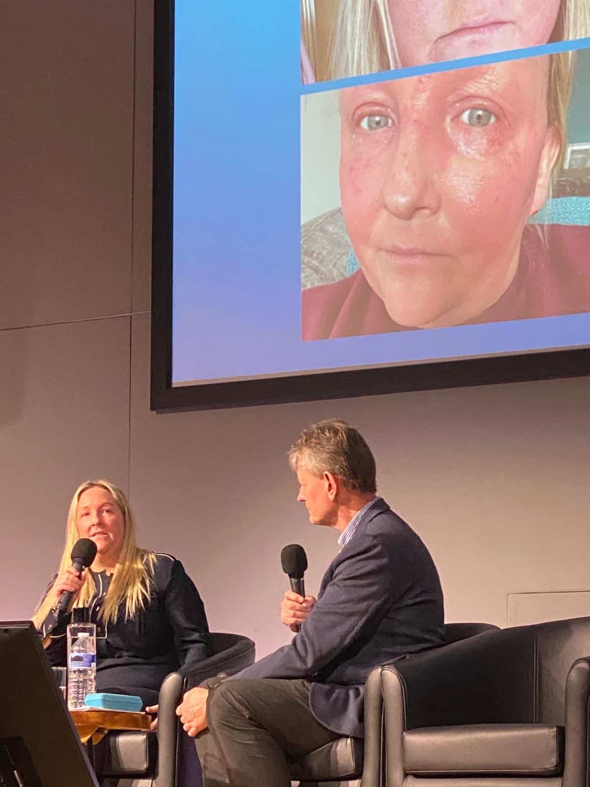 National Eczema Society Chief Executive, Andrew Proctor speaking to eczema warrior Kym Dawson on a stage. There are photos behind them are visible eczema on Kym's face.