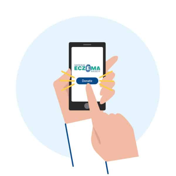 National Eczema Society