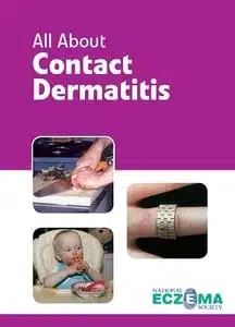 Contact Dermatits