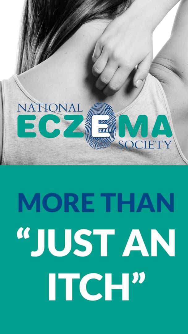 ECO - Eczema Care Online