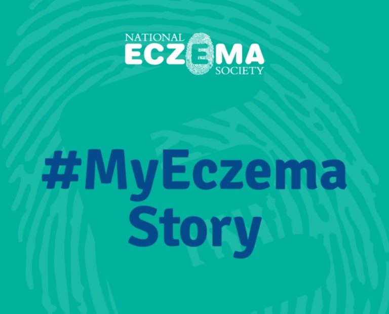 My Eczema Story | National Eczema Society