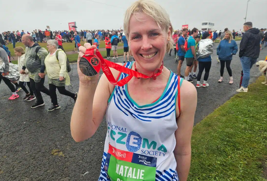 A white women, with visible eczema on her face, is wearing a National Eczema Society running vest. They are holding a Great North Run 2024 finisher medal.